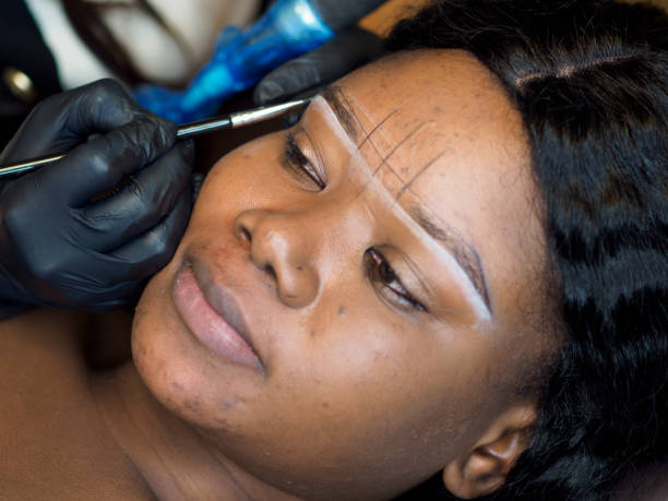 Brow Treatments